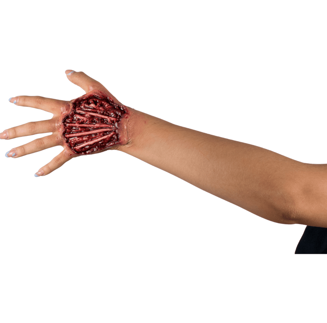 Applience - Tendon injury - PartyExperts