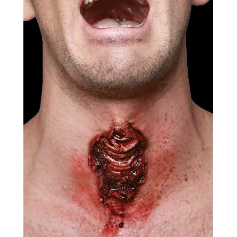 Applience - Traqueotomy - PartyExperts